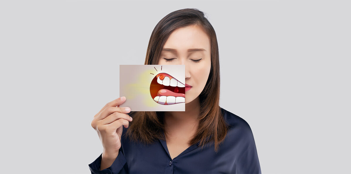 Girl holding a teeth board for a gum disease